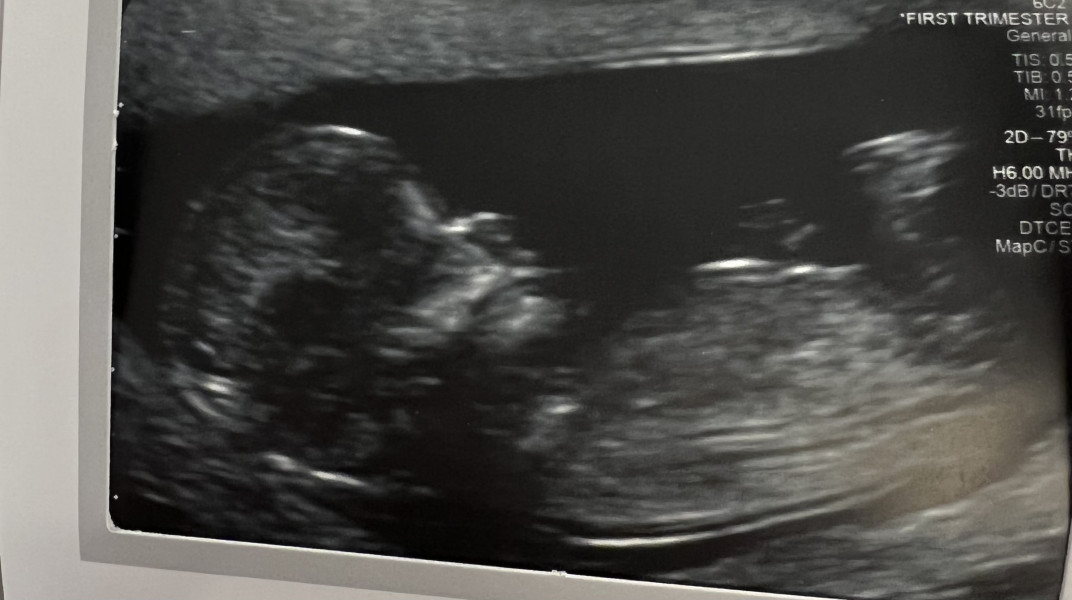 Nub Theory- Gender guesses welcome 