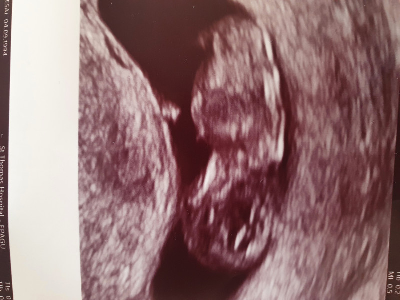 Due December '22 thread 2!