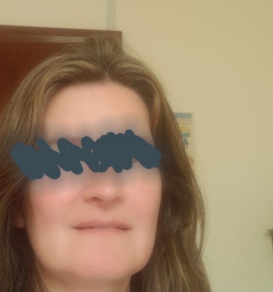 If you have good skin (on your face)...