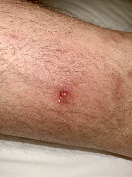 Look at what DP's cooking