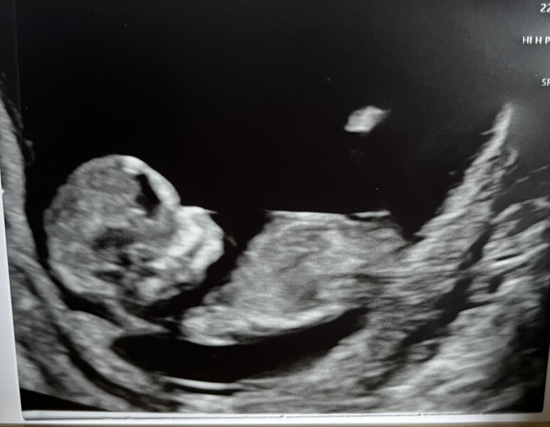 Due December '22 thread 2!