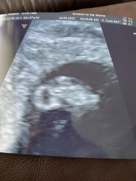 Due December '22 thread 2!