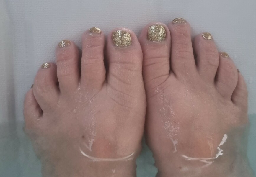 Second toe longer than big toe
