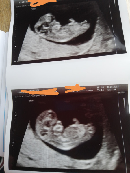 👶 Due November 2022 - part II 🎆