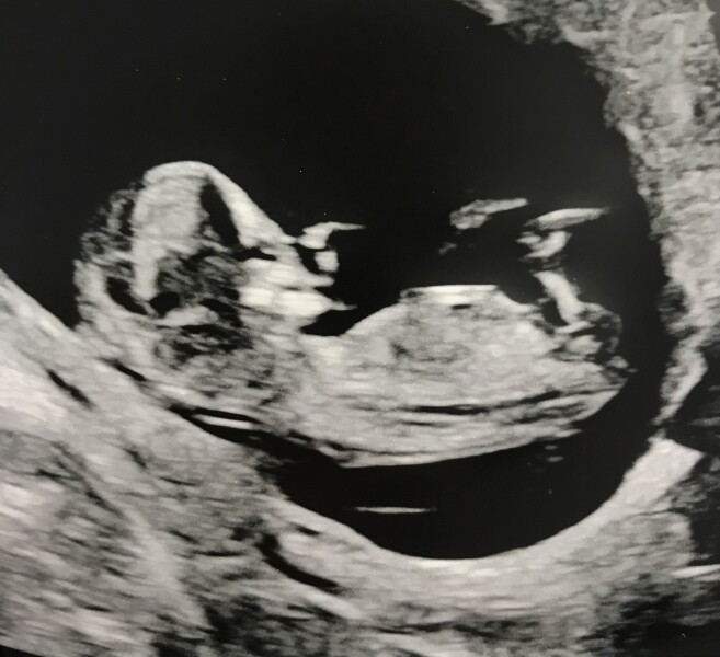 Due December '22 thread 2!