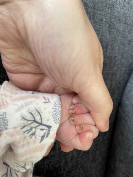 Baby nail discolouration