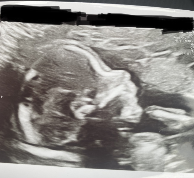 Boy or girl ?