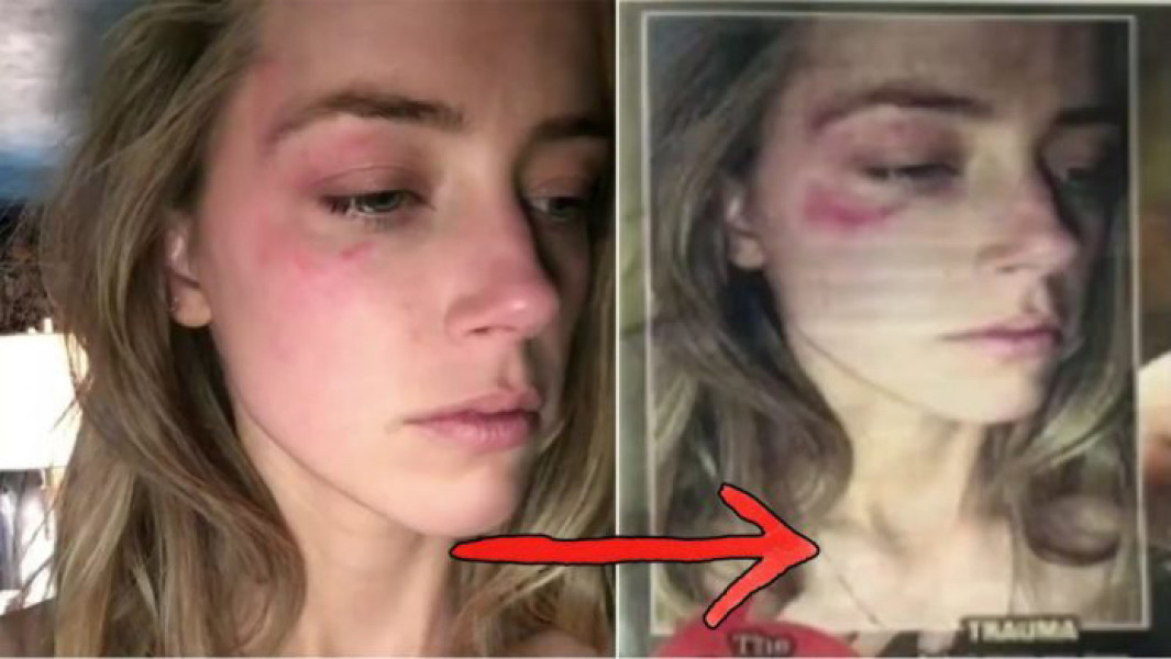 Anyone watching Amber heard take the stand?