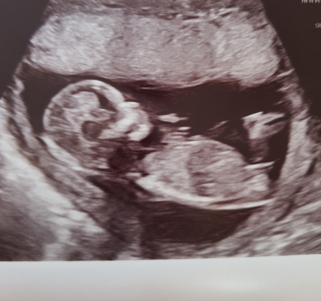 Nub Theory- Gender guesses welcome 