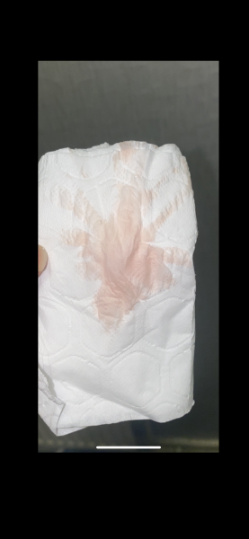 To Blame Plan B Pill - Warning: Graphic image