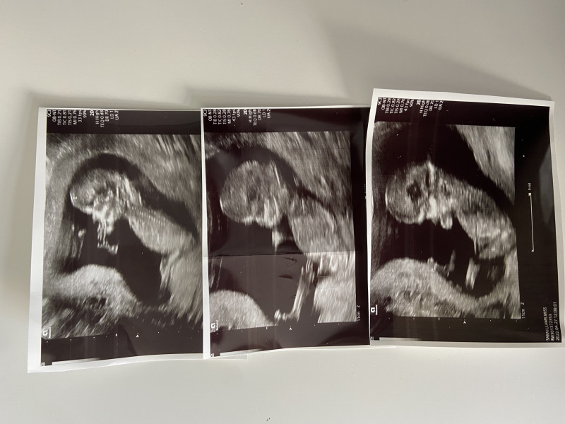 Nub Theory- Gender guesses welcome 