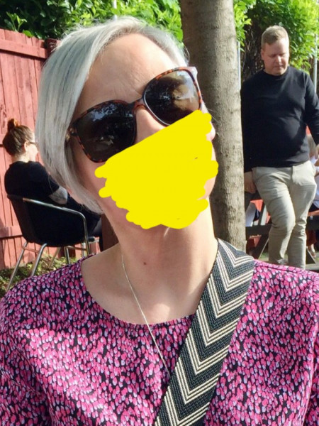 Tried to embrace the grey and am struggling, but allergic to hair dyes.. help please! 
