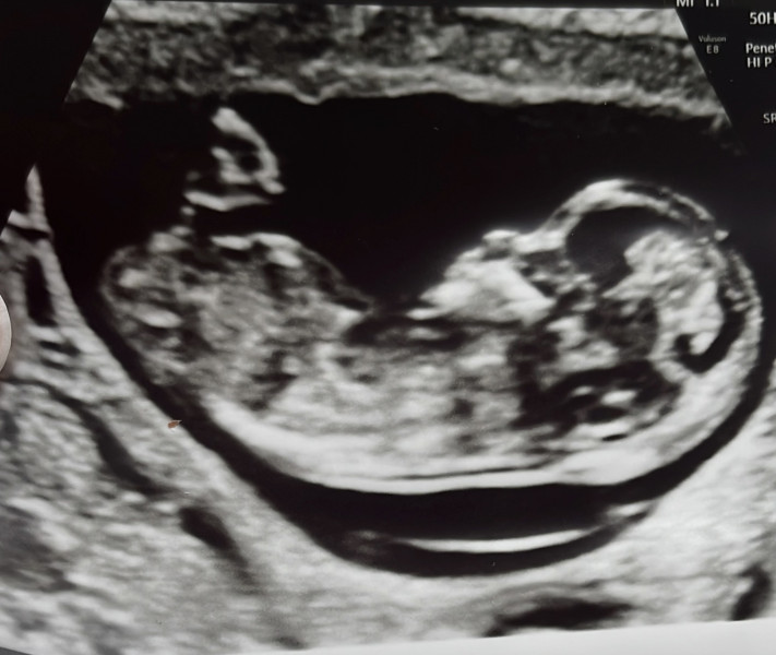 Told myself I wouldn't do this...but sex guesses?