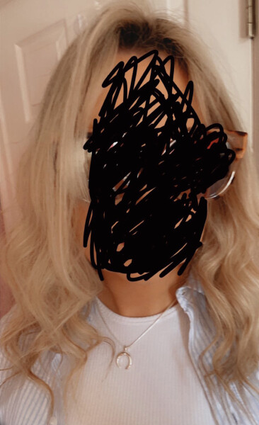 Is my hair too damaged to fix? (Pic included )