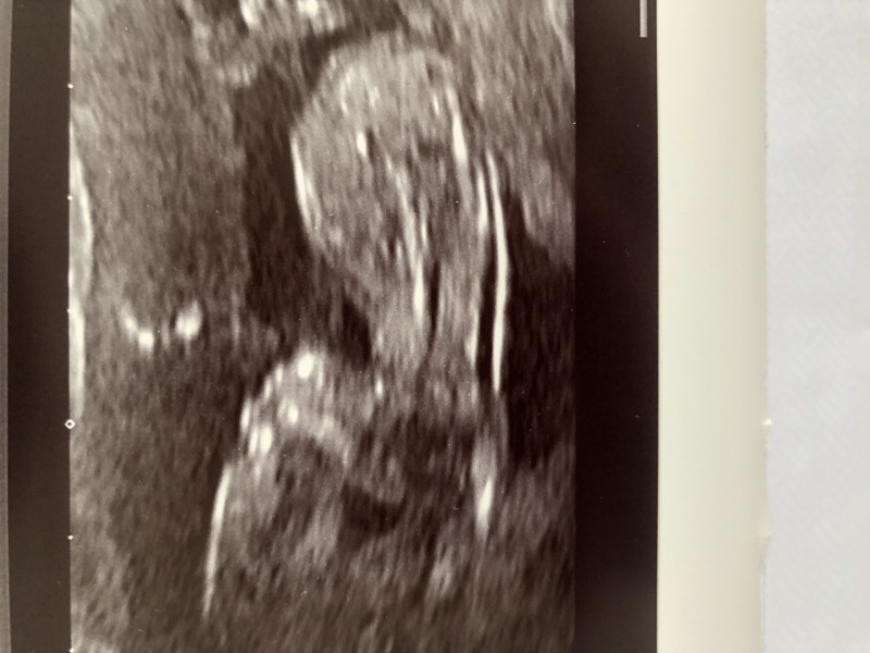 Nub theory 12 weeks 6 days 