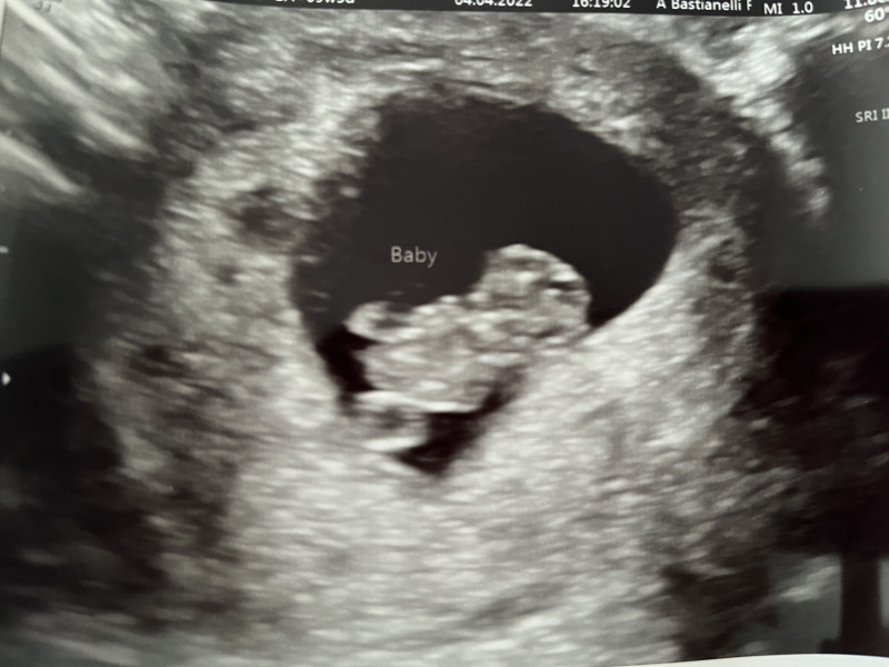 Navigating pregnancy after loss thread 2