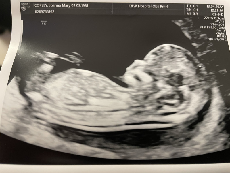 Gender prediction!
