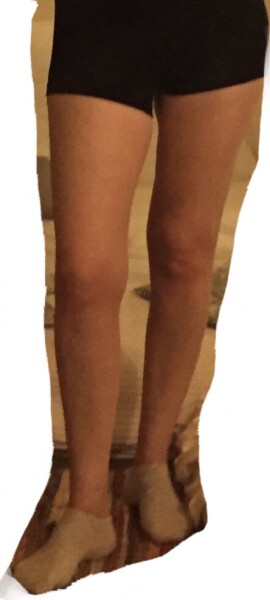 What's going on with my shape? (pics)