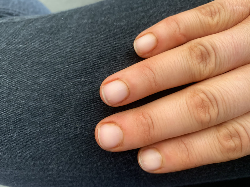 Nails