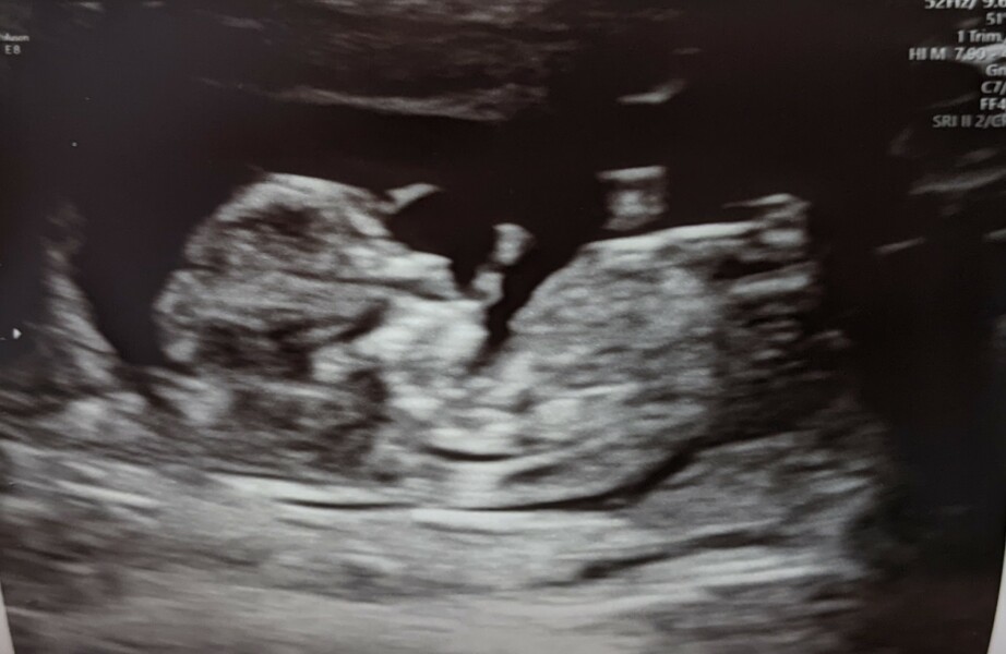 Due December '22 thread 2!