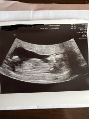 Gender guesses/nub theory? 