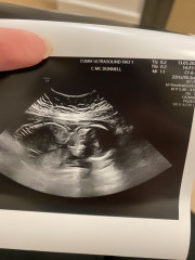 Due September 2022 (Thread 6!)
