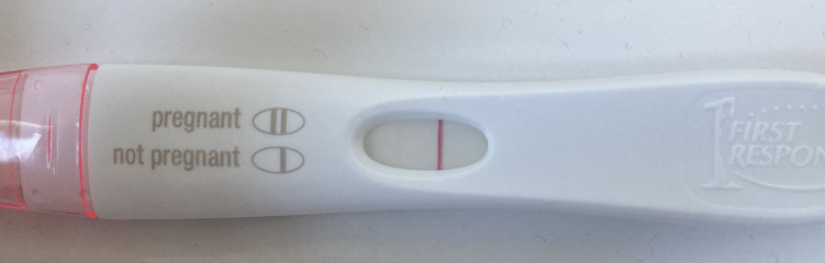 Line on FRER - tell me about indents etc!