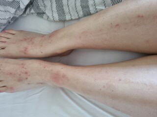 Skin issues, any ideas??