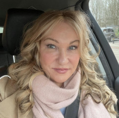 Would you have a face lift?