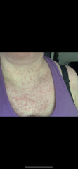 Skin issues, any ideas??
