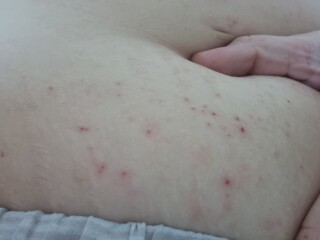 Skin issues, any ideas??