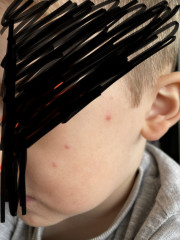 What are these spots?? 
