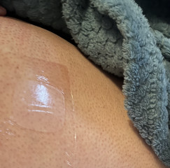 Any advice for patch application?