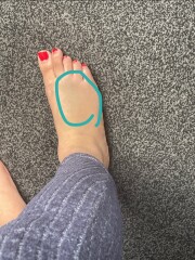 Foot going blue, what's going on?