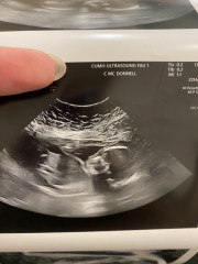 Due September 2022 (Thread 6!)