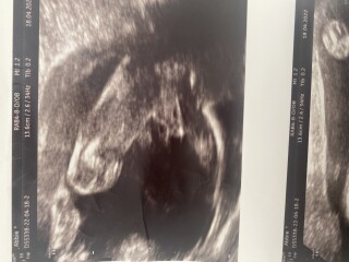 Gender scan 