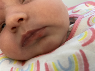 Baby cold sore or pimple? Help!
