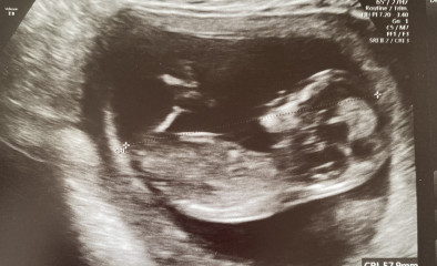 Just for fun... Gender guesses welcome