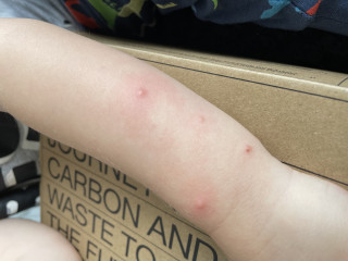 What are these spots?? 
