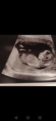 Boy or girl? guesses much appreciated :) 