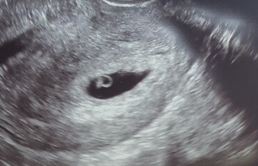 IVF buddies April/May
