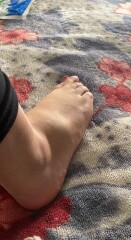 Foot going blue, what's going on?