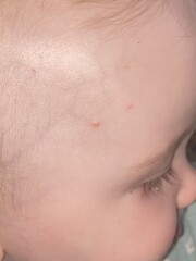 What are these spots?! 
