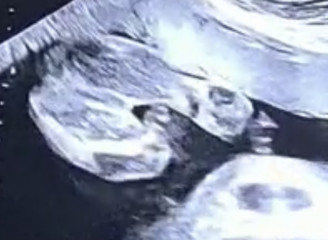 Gender guesses please ❤️