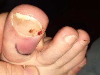 Does this need medical attention? Pics
