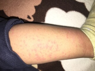 Is the is some kinda of an allergy? Advice? 