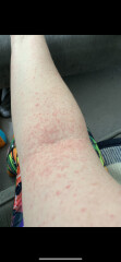 Skin issues, any ideas??