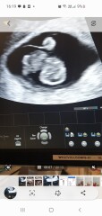 IVF buddies April/May