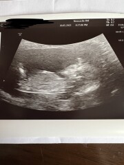 Gender guesses/nub theory? 