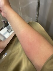 Is this an infection? Help! (Photos attached)
